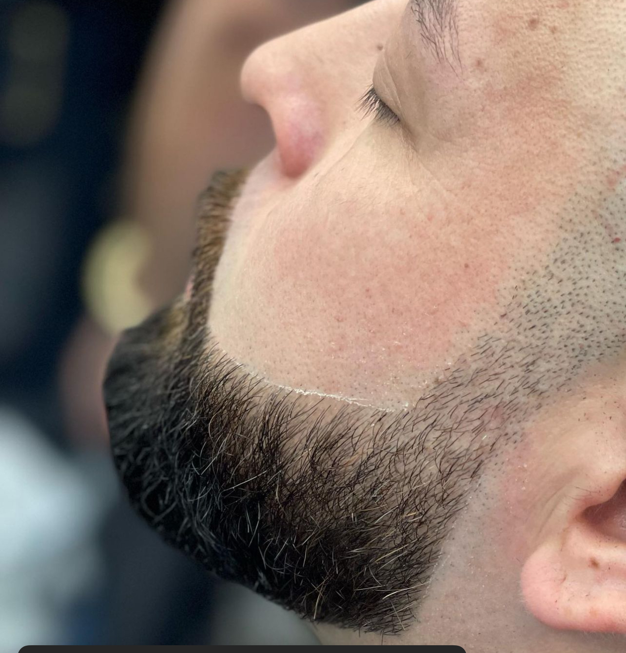 A beard line-up finished razor sharp along the cheek